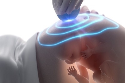 4D ultrazvuk + nalaz specijaliste + snimak ultrazvuka na disku